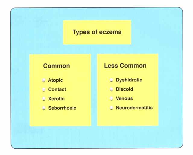 The Main Types Of Eczema